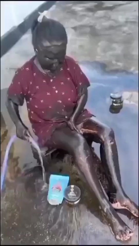 Post 1 by Hair Growth Tips on TikTok (video)