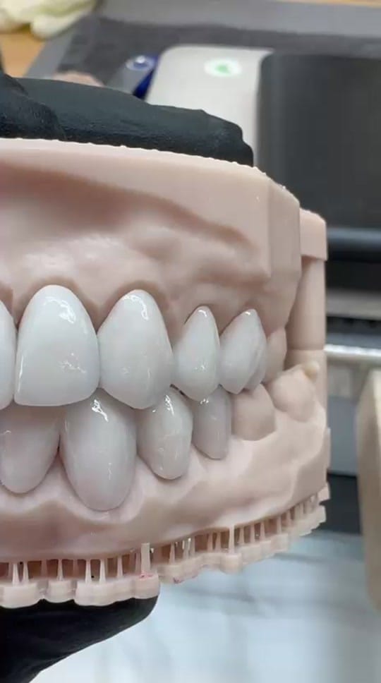 Post 5 by Smiles Family Dentistry on TikTok (video)