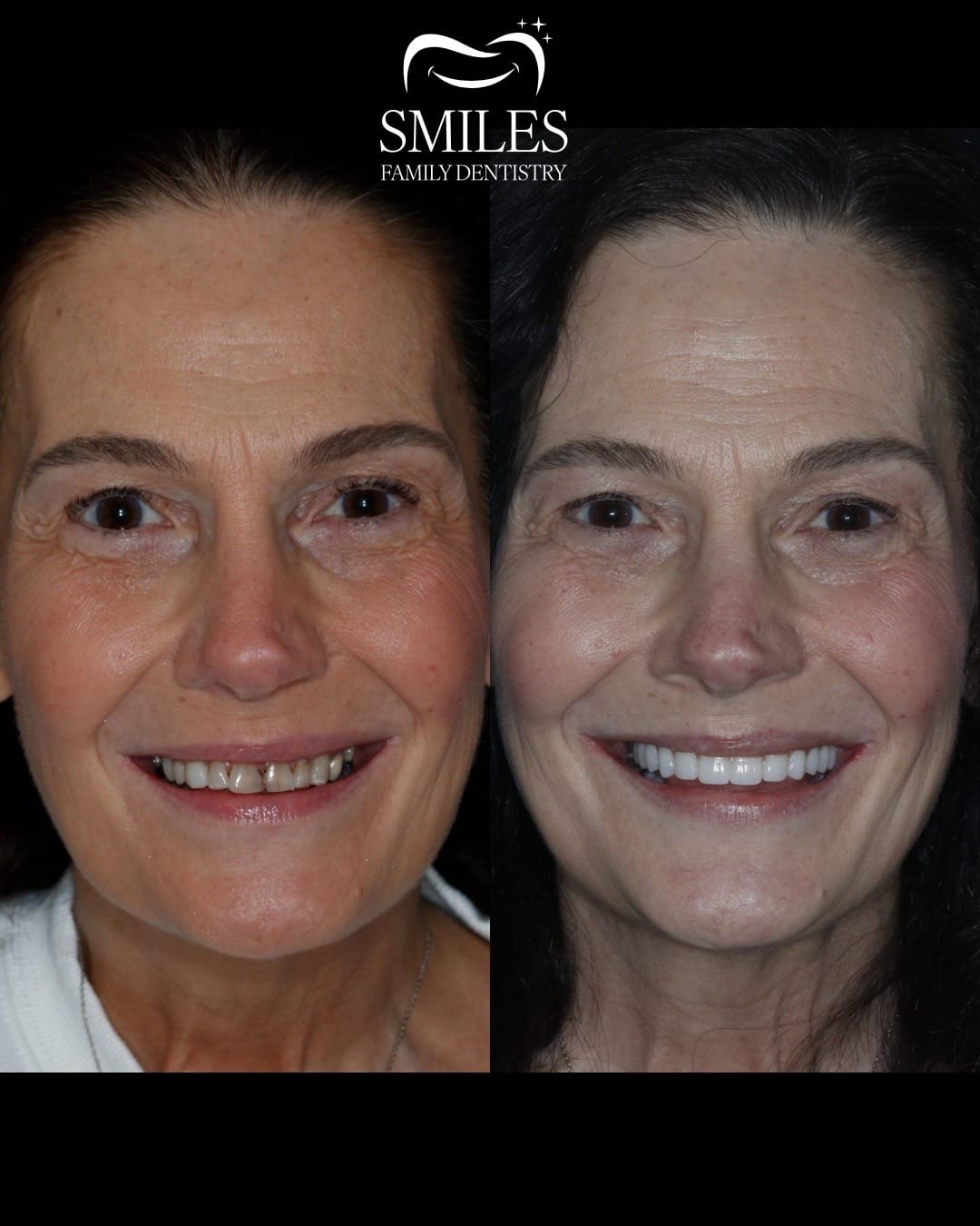 Post 9 by Smiles Family Dentistry on TikTok (video)