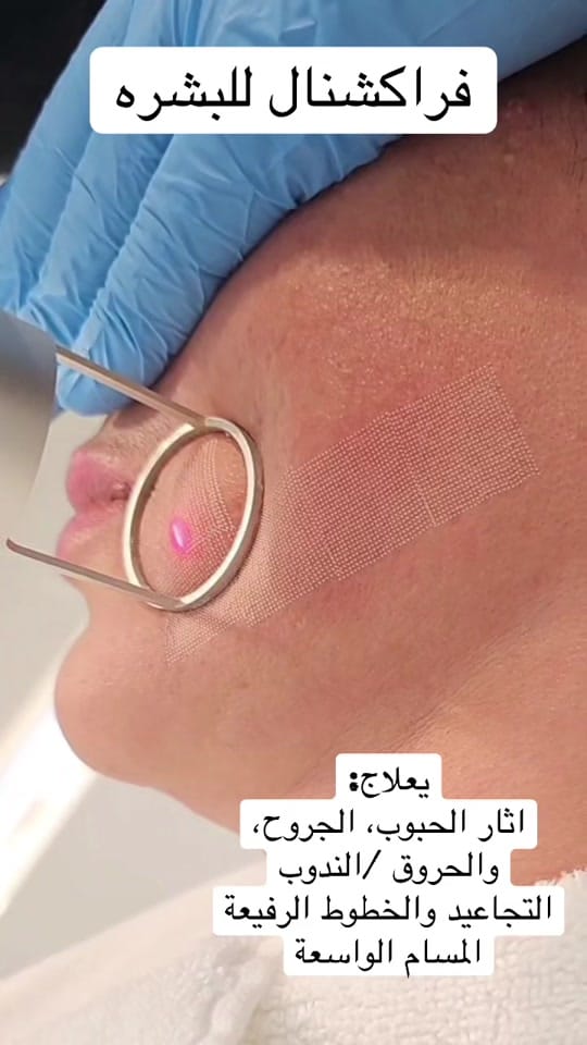 Post 10 by Drbernardghanem on TikTok (video)