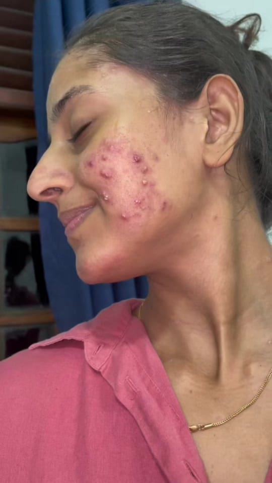 Post 8 by Rivipaba Pathirana 🎀🇦🇺 on TikTok (video)
