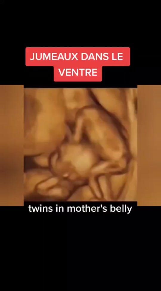Post 10 by fab on TikTok (video)