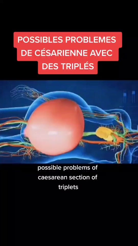Post 6 by fab on TikTok (video)