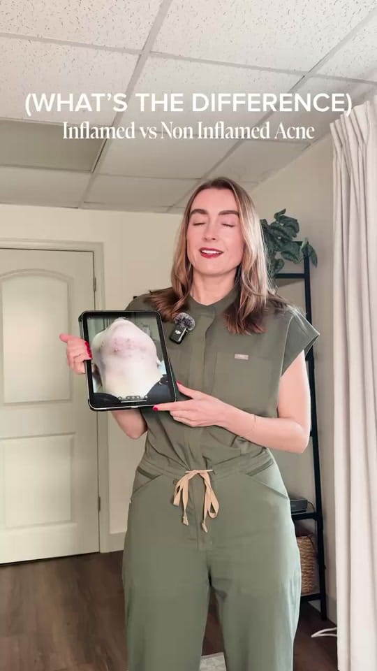 Post 3 by Sarah | Acne Expert on TikTok (video)