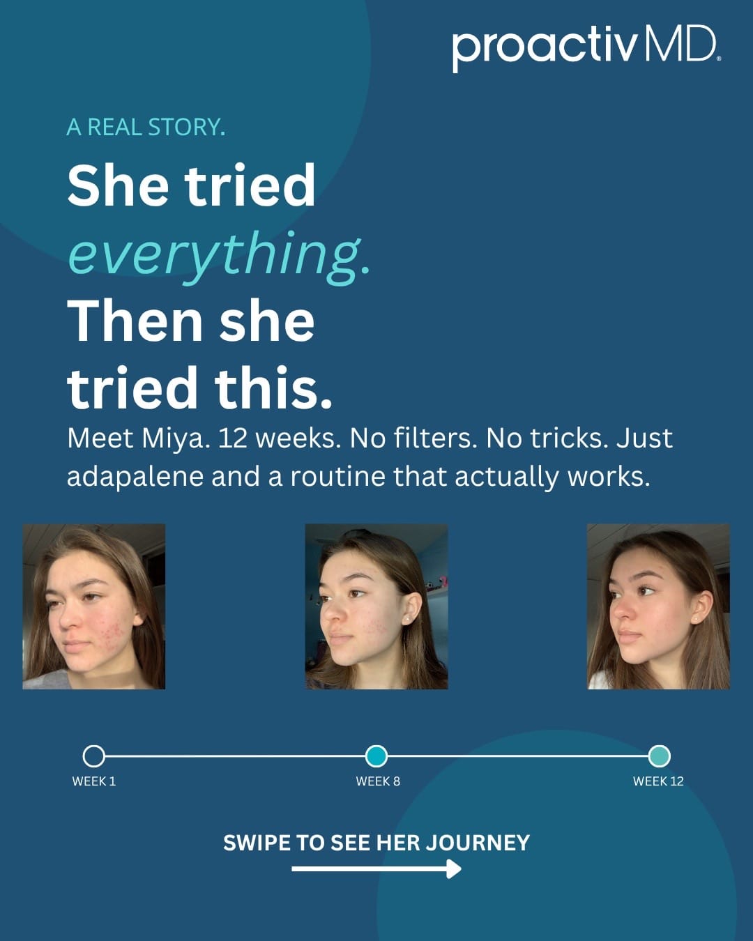 Post 6 by proactiv on TikTok (video)