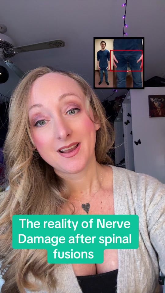 Post 8 by Brandy Spinal:Pain advocate 🖤 on TikTok (video)
