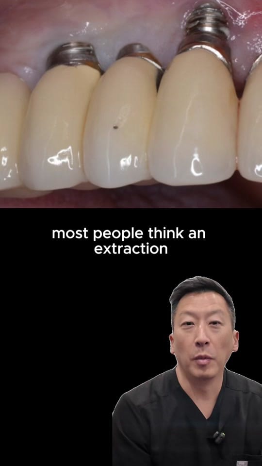 Post 4 by Dallas Smile Specialists 🦷 on TikTok (video)