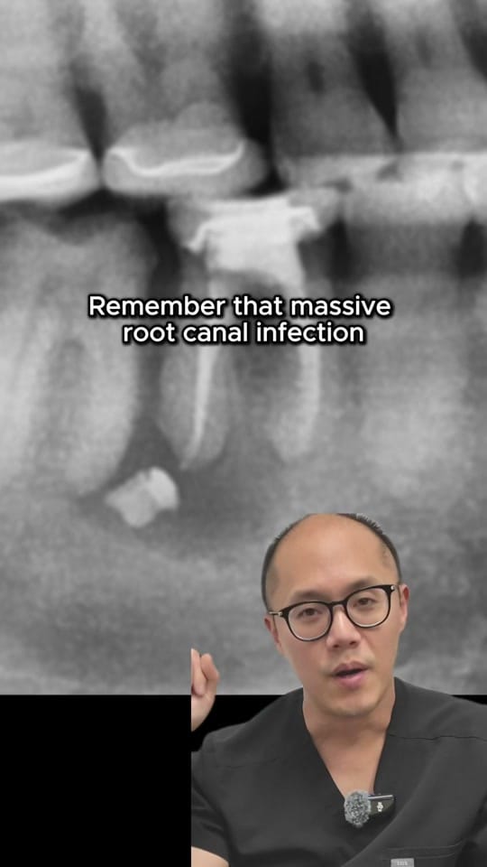 Post 6 by Dallas Smile Specialists 🦷 on TikTok (video)