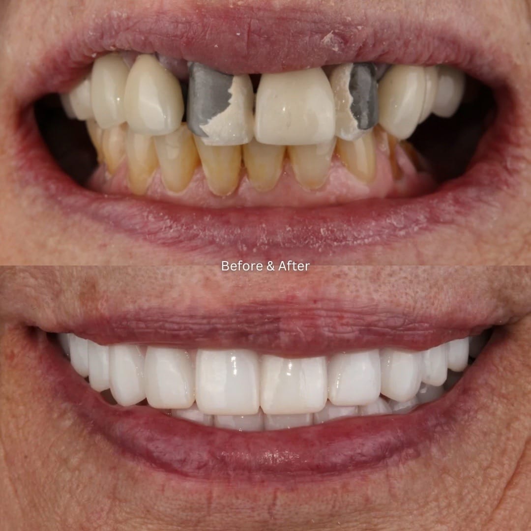 Post 2 by Dallas Smile Specialists 🦷 on TikTok (video)