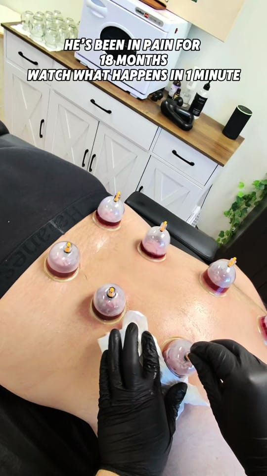 Post 8 by The Cup Doc on TikTok (video)