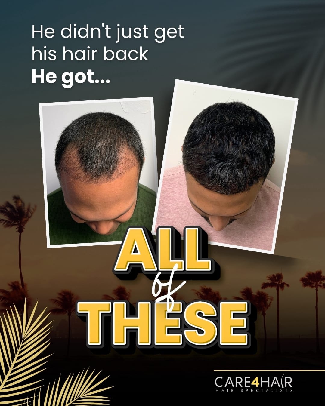 Post 6 by Hair Transplant Miami on TikTok (video)