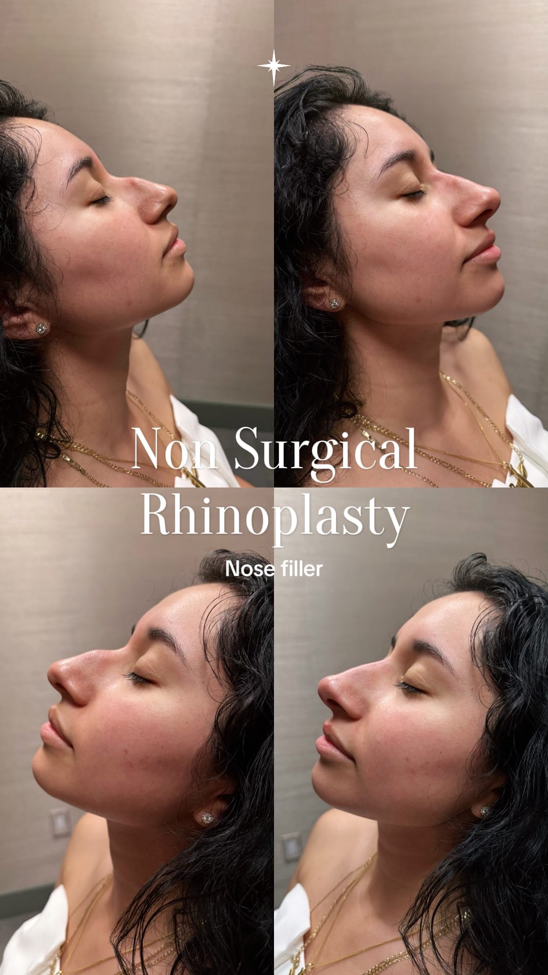 Post 1 by Annie Zavitsanos, CRNP on TikTok (video)