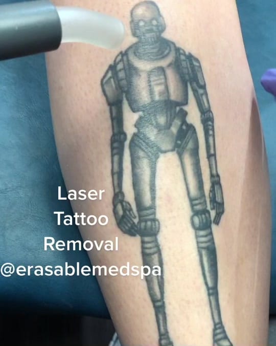 Post 9 by erasablemedspa on TikTok (video)