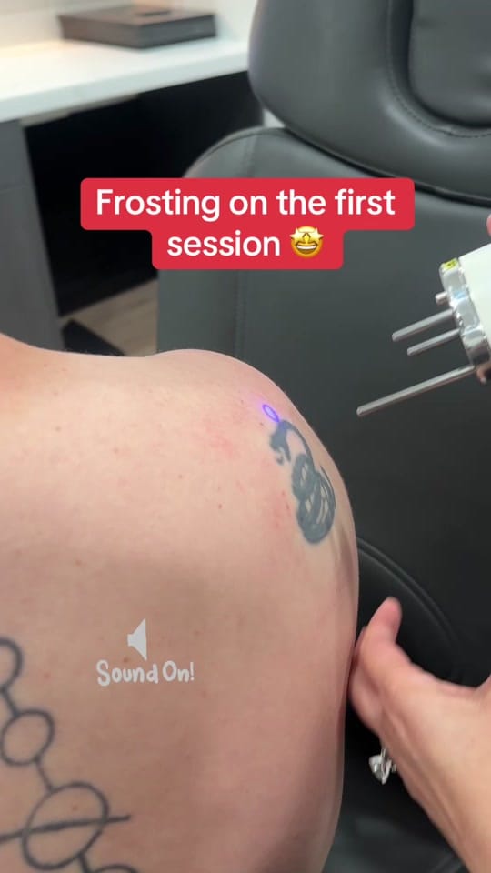 Post 3 by erasablemedspa on TikTok (video)