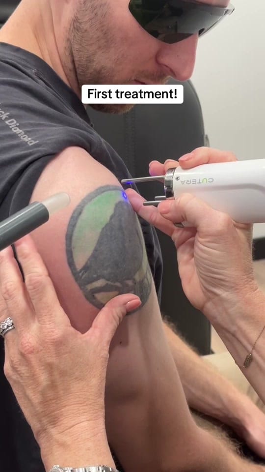 Post 1 by erasablemedspa on TikTok (video)