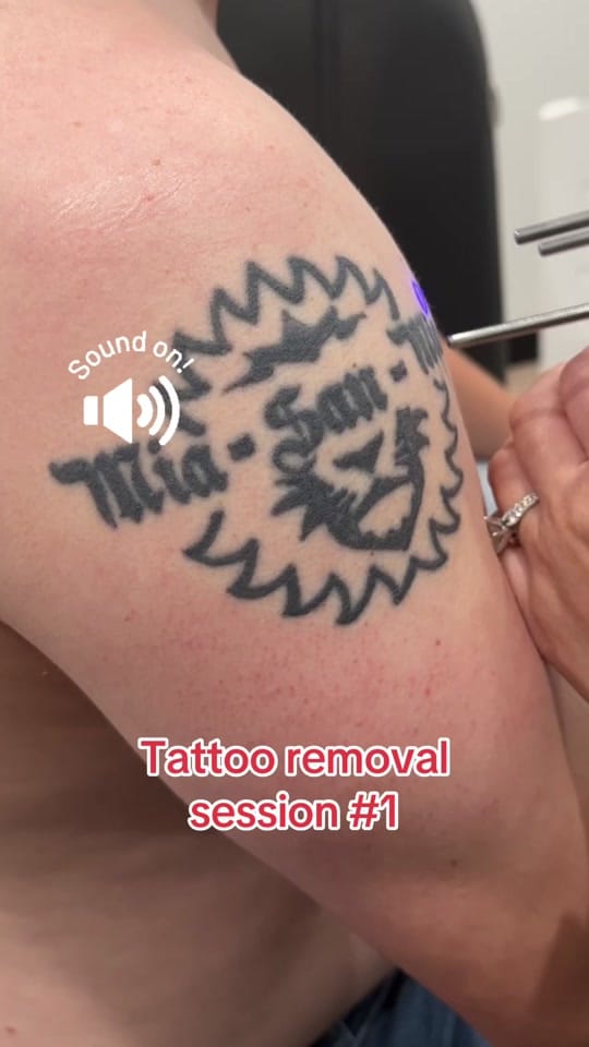 Post 4 by erasablemedspa on TikTok (video)