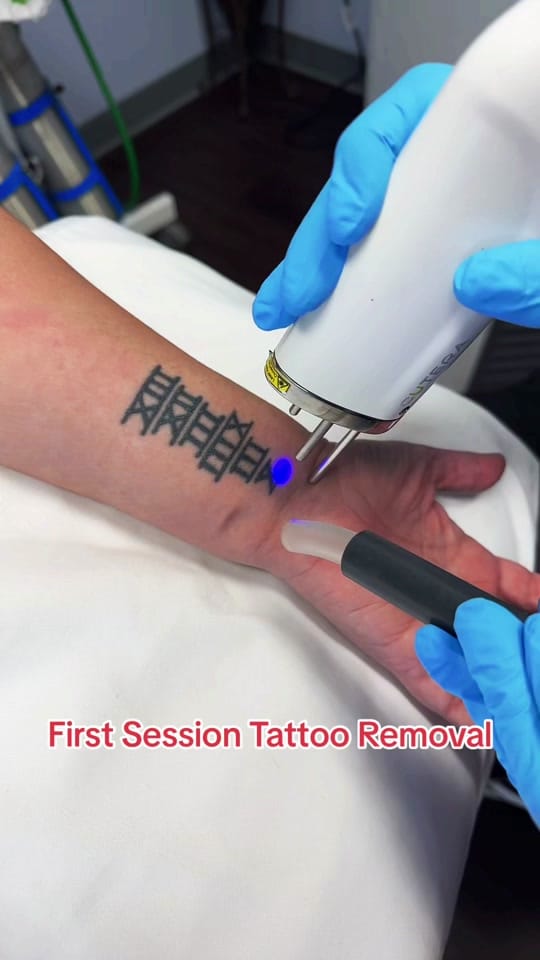 Post 6 by erasablemedspa on TikTok (video)