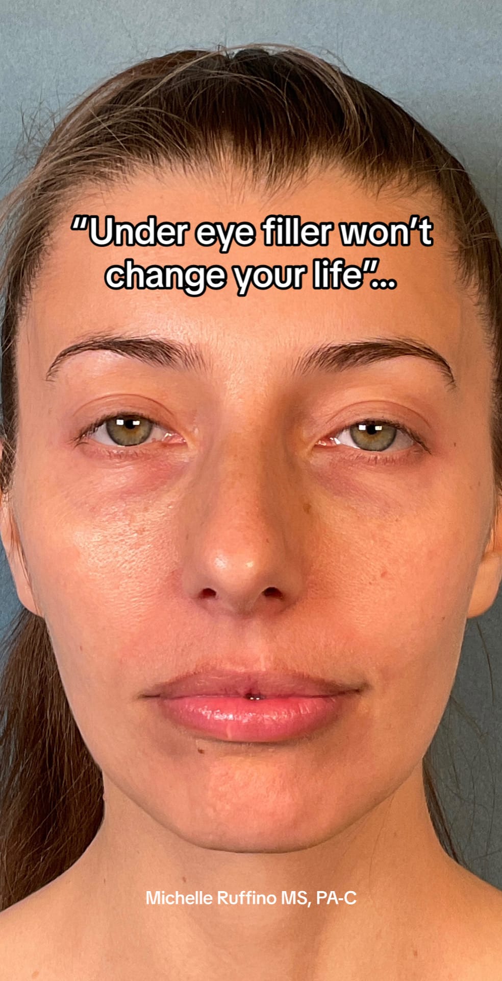 Post 10 by Michelle Ruffino, MS, PA-C on TikTok (video)