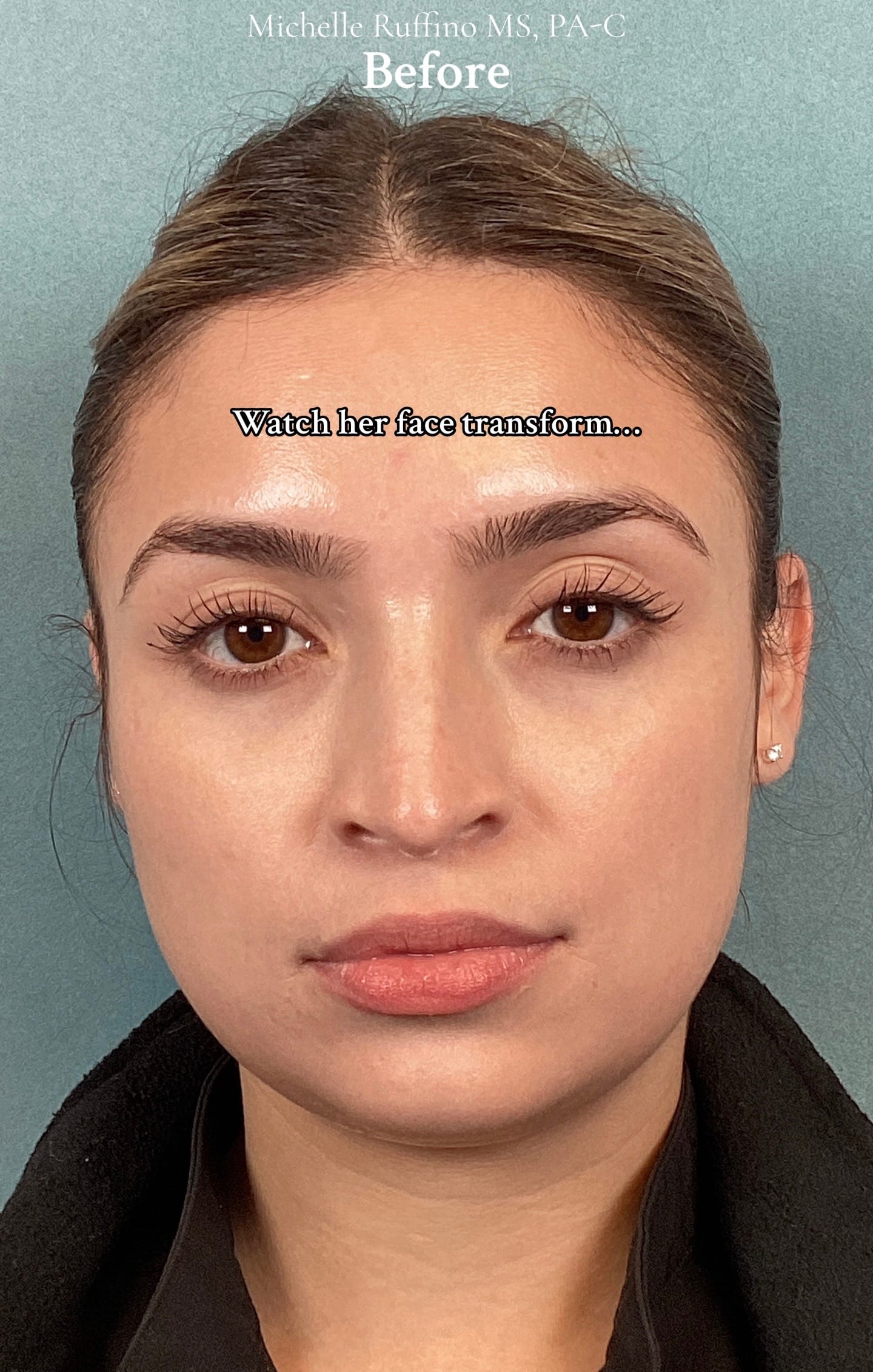 Post 9 by Michelle Ruffino, MS, PA-C on TikTok (video)