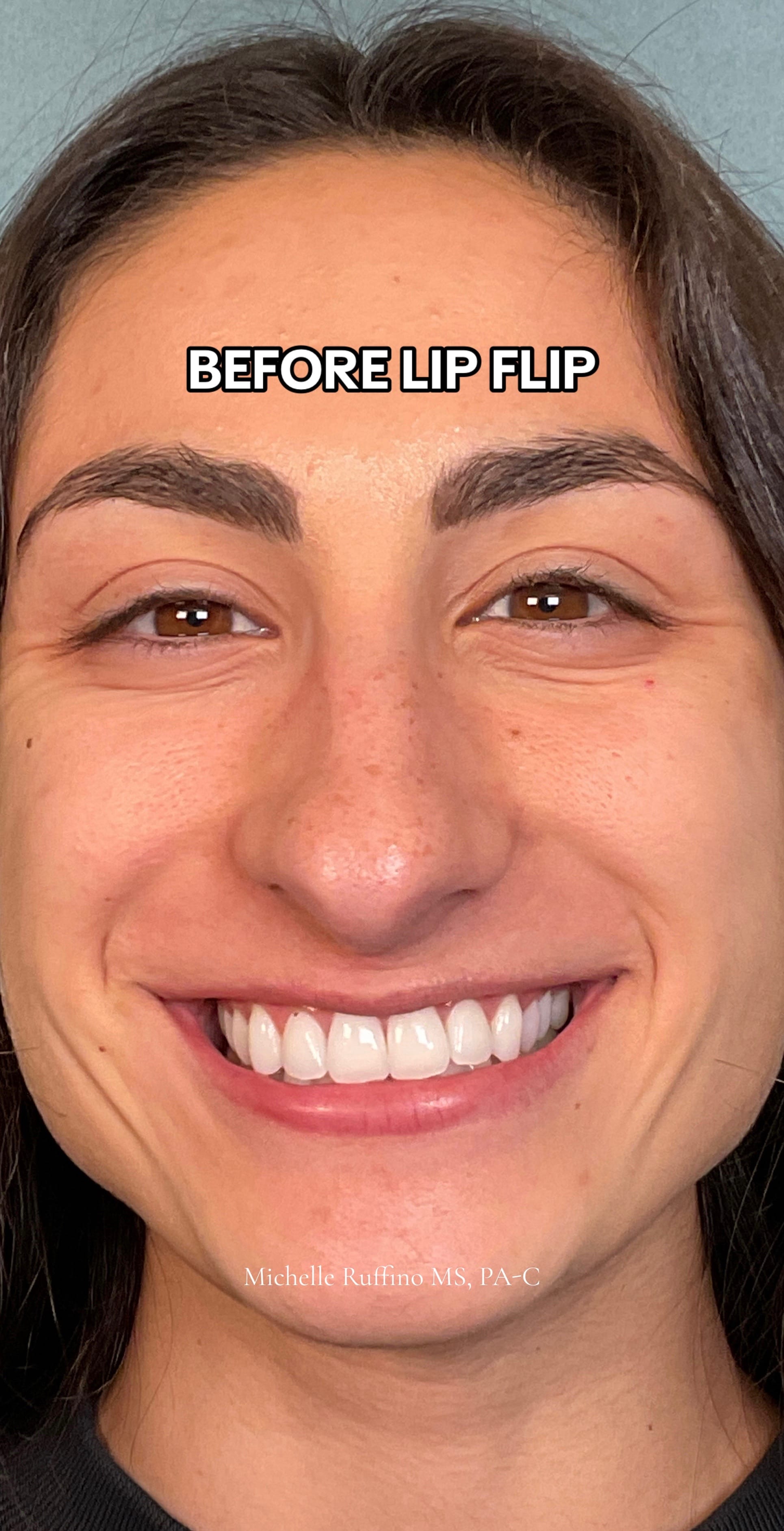 Post 8 by Michelle Ruffino, MS, PA-C on TikTok (video)