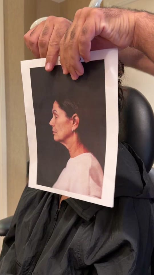Post 4 by DrFaceliftMiami Chopra on TikTok (video)