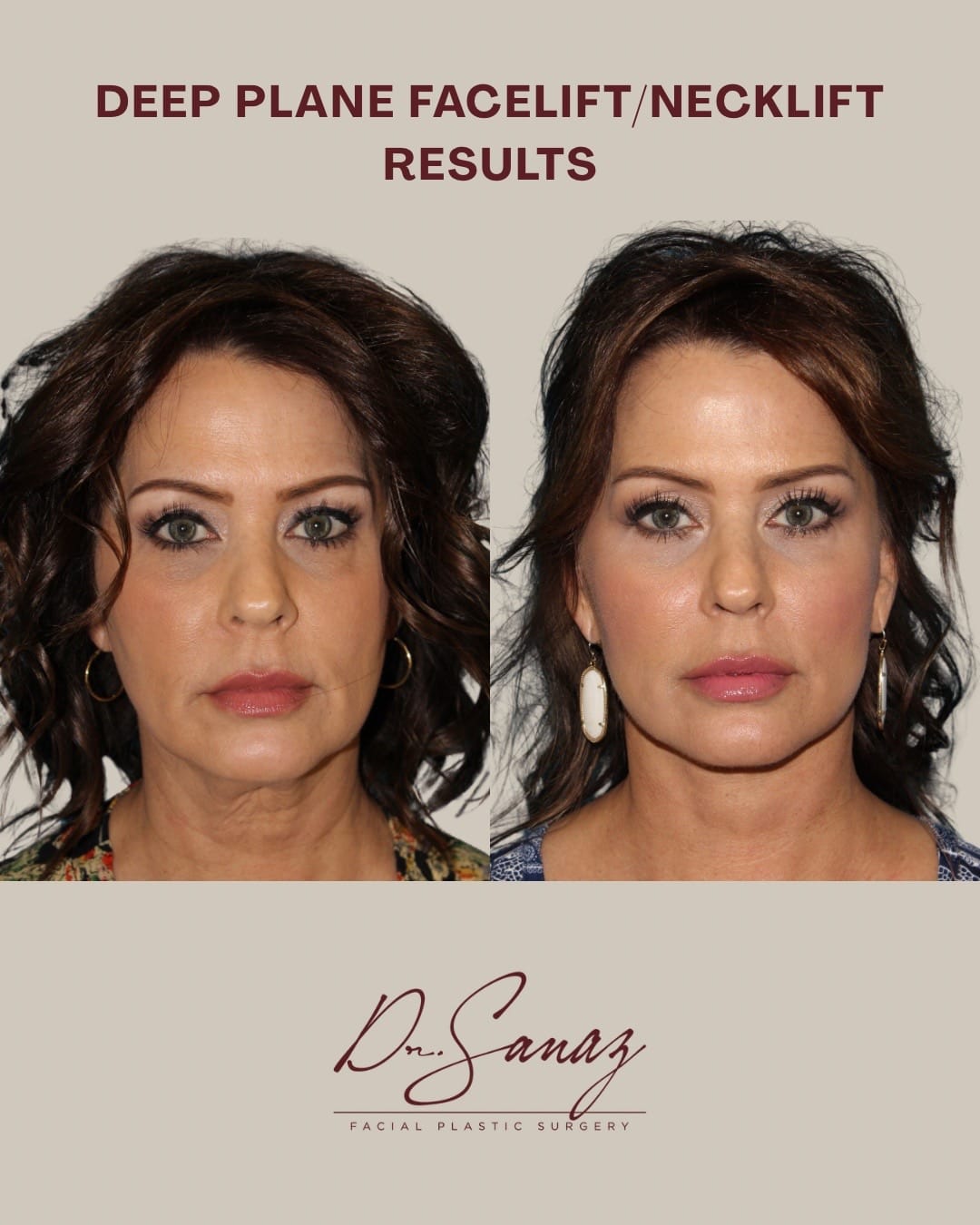 Post 1 by Dr. Sanaz Harirchian on TikTok (video)