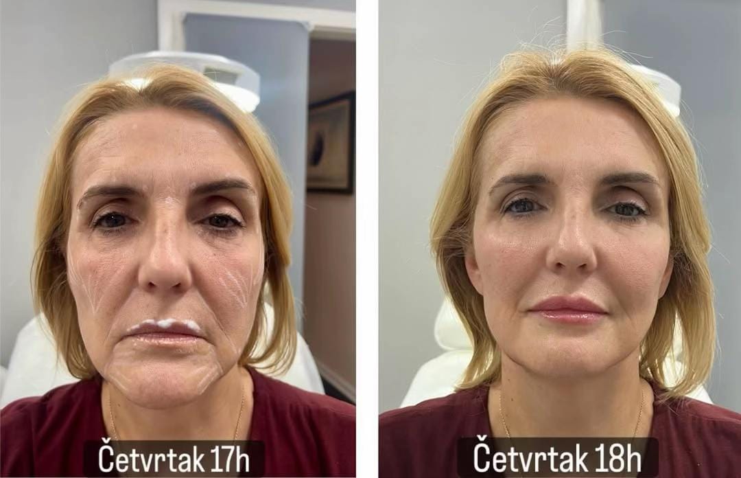 Post 5 by Dr Dejan Antonic on TikTok (video)