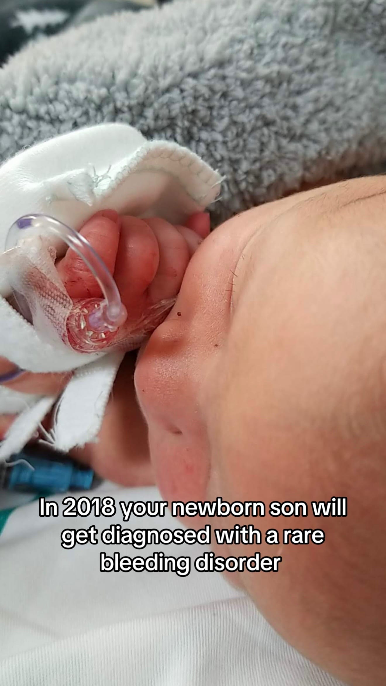 Post 6 by Kaitlin | Hemophilia Mama on TikTok (video)