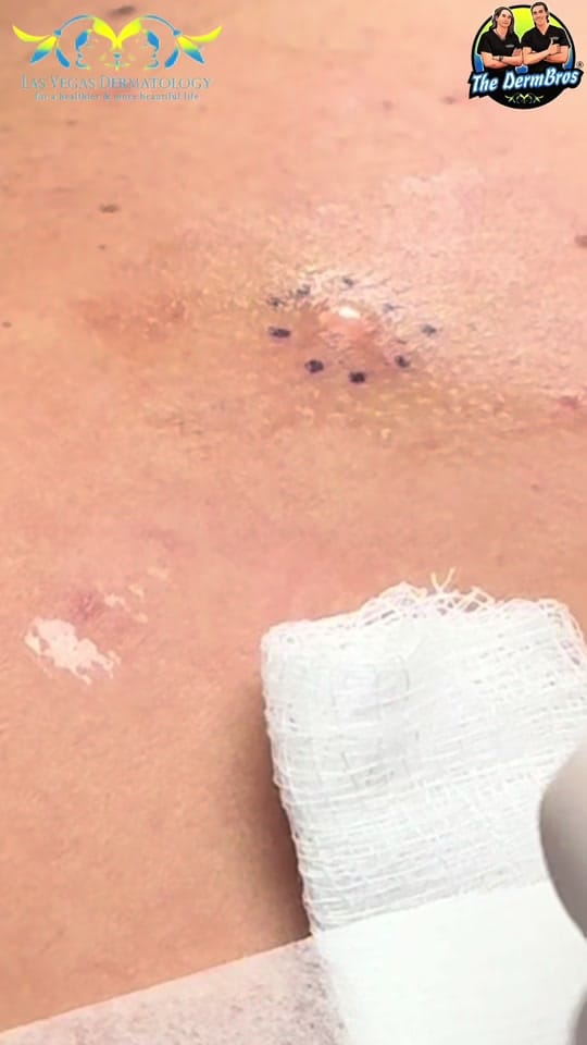 Post 6 by Dr. Vegas on TikTok (video)