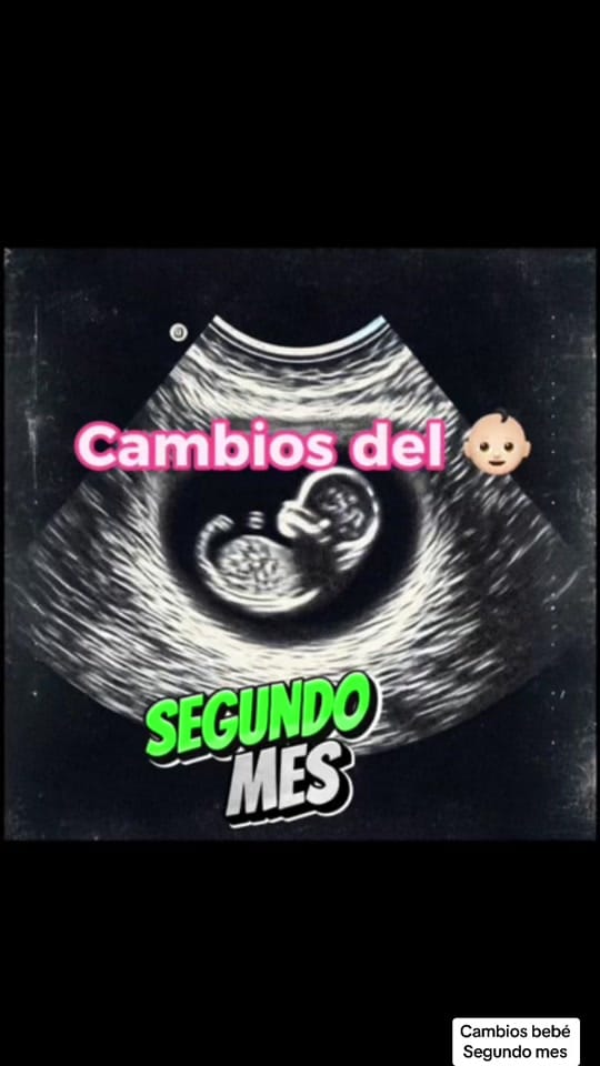 Post 8 by Baby en Camino 👶🏻 on TikTok (video)