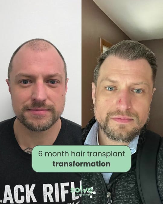 Post 7 by Solve Clinics on TikTok (video)