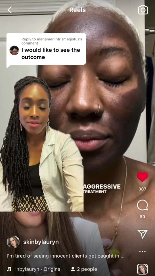 Post 8 by Terri | Tox,Filler injector CT on TikTok (video)