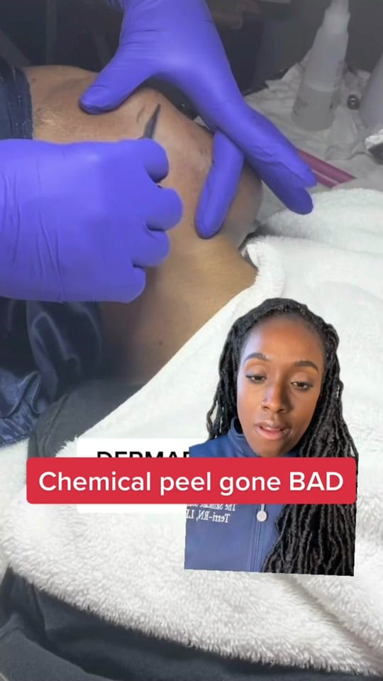 Post 10 by Terri | Tox,Filler injector CT on TikTok (video)