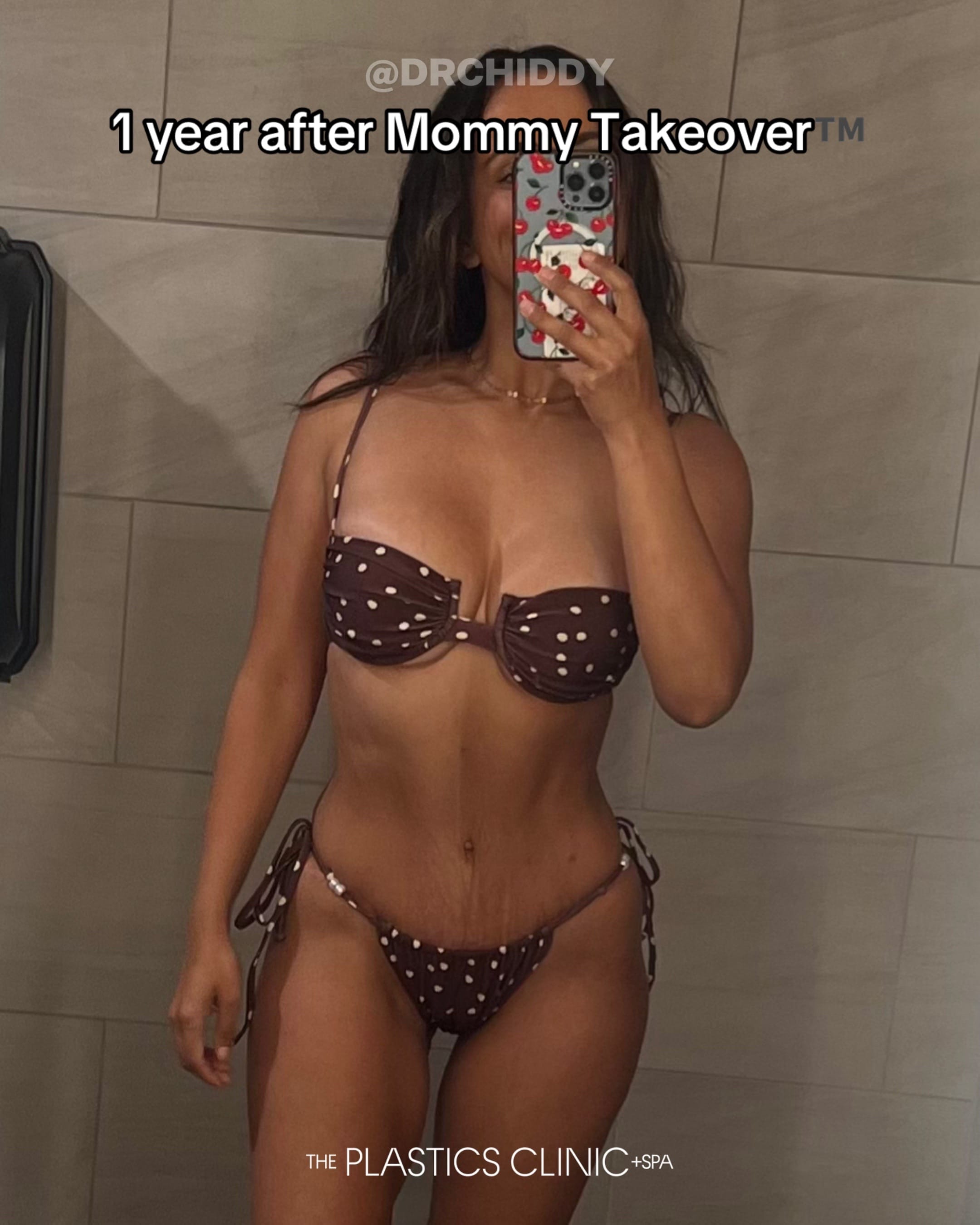 Post 7 by Dr. Chiddy ⭐️ Plastic Surgeon on TikTok (video)