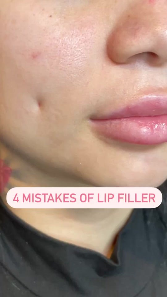 Post 8 by The Blonde Botox on TikTok (video)