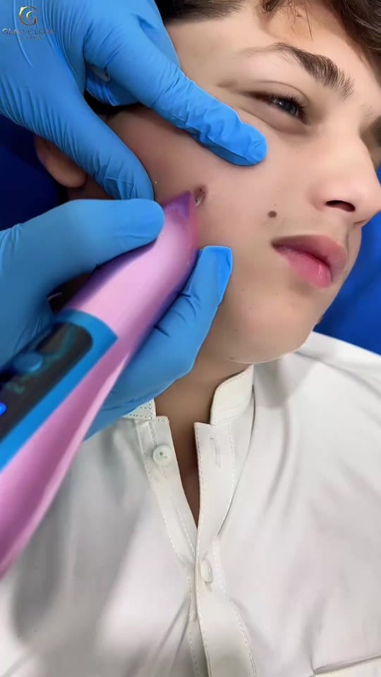 Post 7 by GLAM GLOW AESTHETIC STUDIO on TikTok (video)