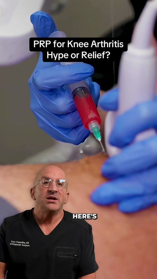 Post 8 by Bone Doctor - Joint Pain MD on TikTok (video)