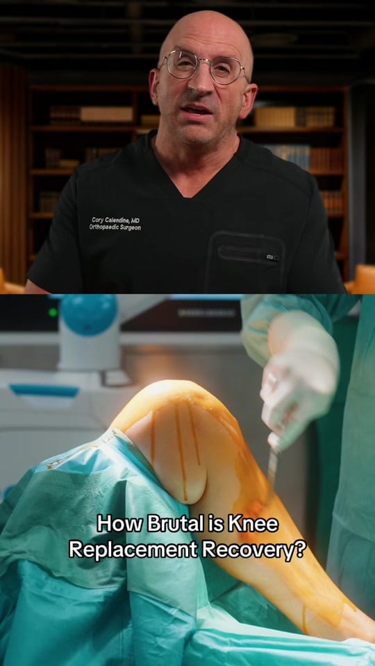 Post 7 by Bone Doctor - Joint Pain MD on TikTok (video)