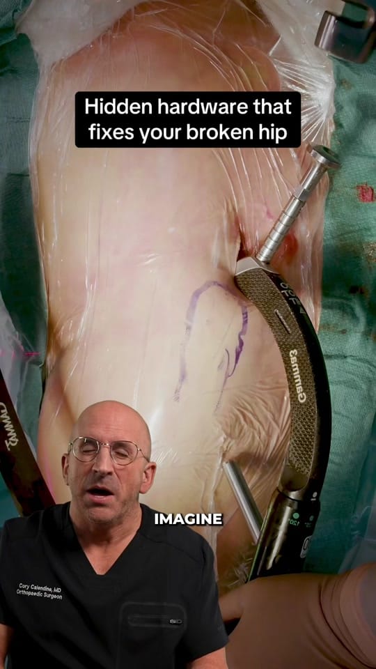 Post 9 by Bone Doctor - Joint Pain MD on TikTok (video)