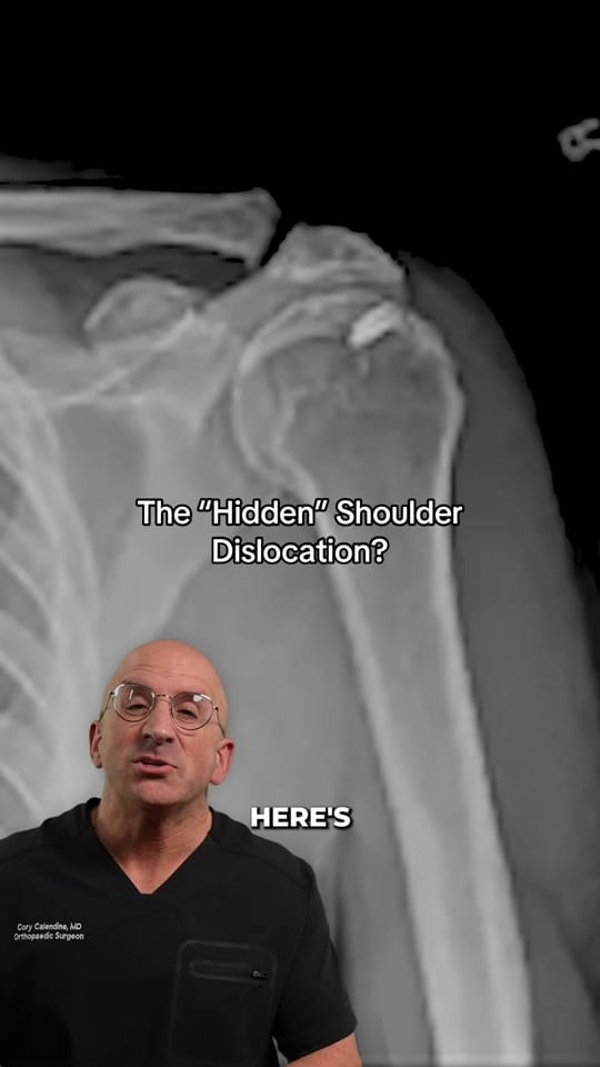 Post 2 by Bone Doctor - Joint Pain MD on TikTok (video)