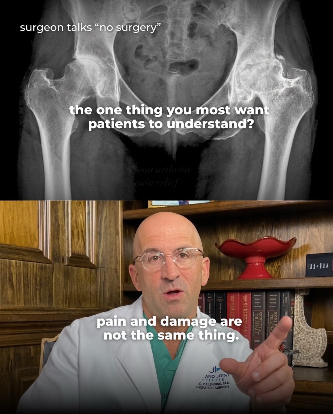 Post 3 by Bone Doctor - Joint Pain MD on TikTok (video)