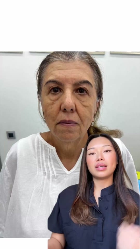 Post 4 by M.Y. Skin Clinic 💋 on TikTok (video)