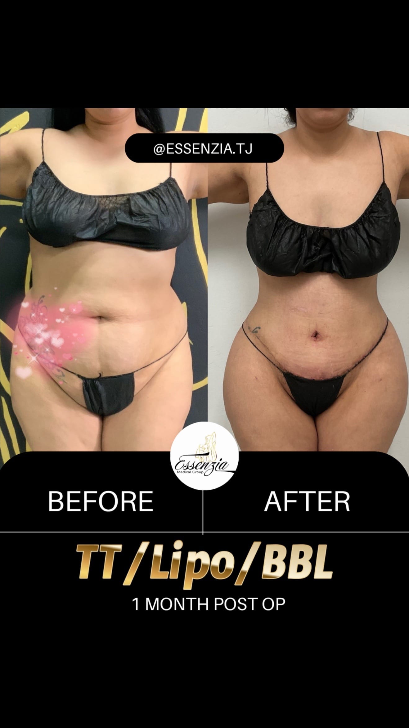 Post 1 by Essenzia Medical Group on TikTok (video)