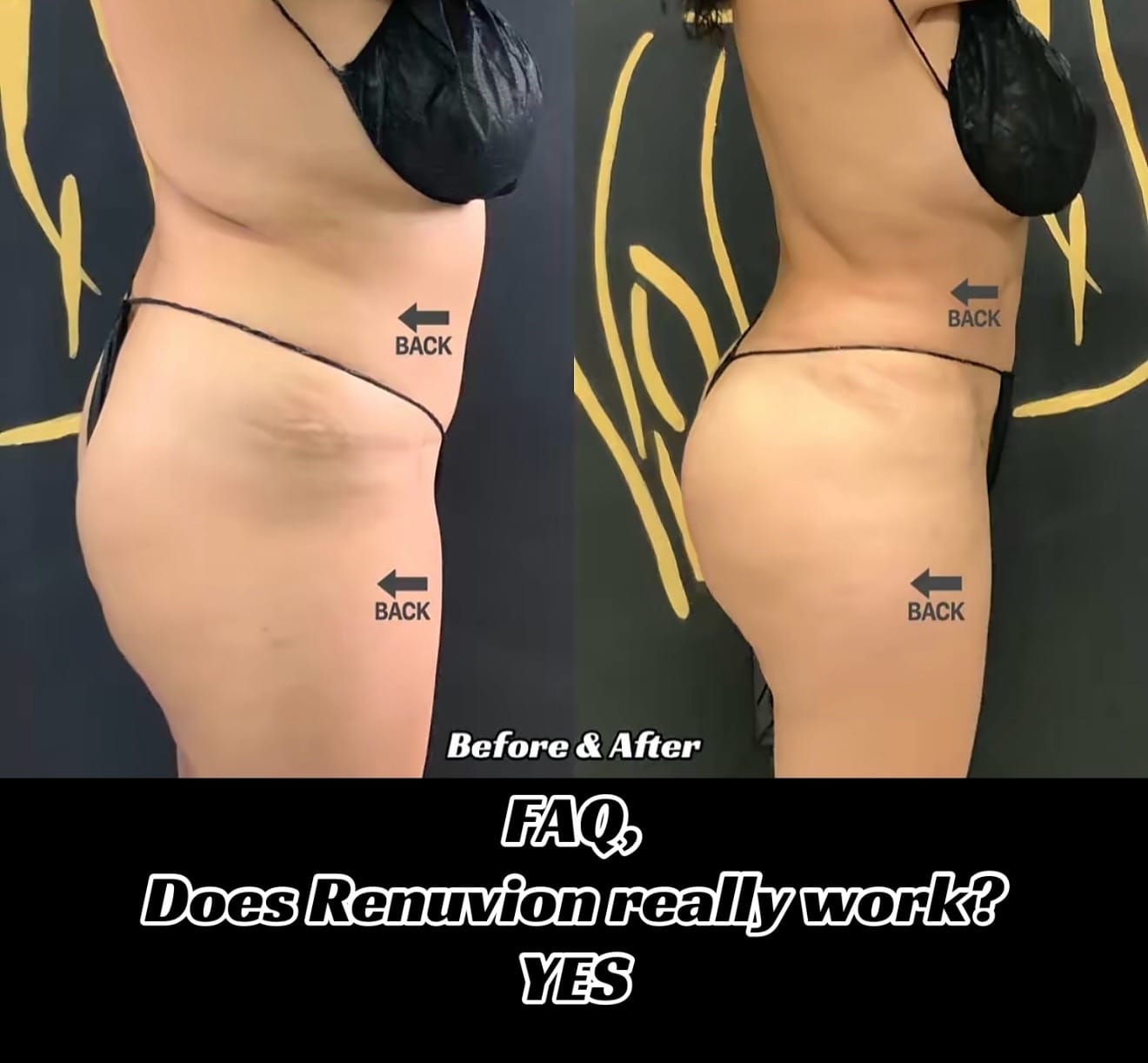 Post 4 by Essenzia Medical Group on TikTok (video)