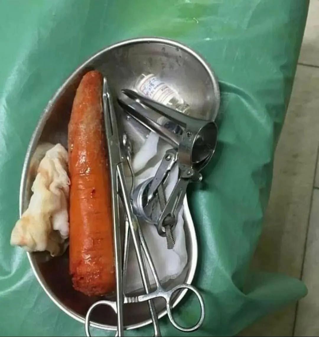 Post 2 by James frank on TikTok (video)