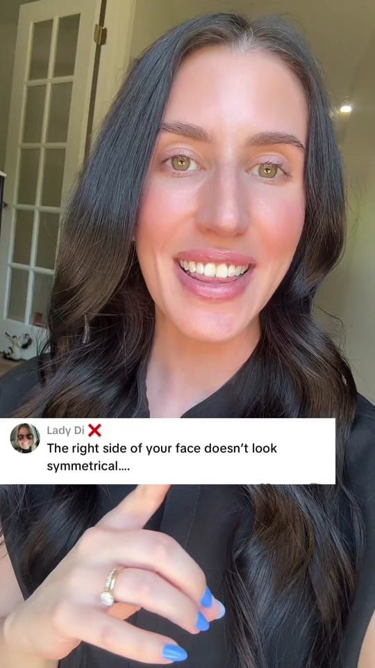 Post 7 by Ally | Delaware Nurse Injector on TikTok (video)