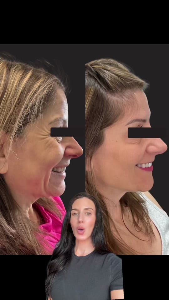 Post 1 by Ally | Delaware Nurse Injector on TikTok (video)