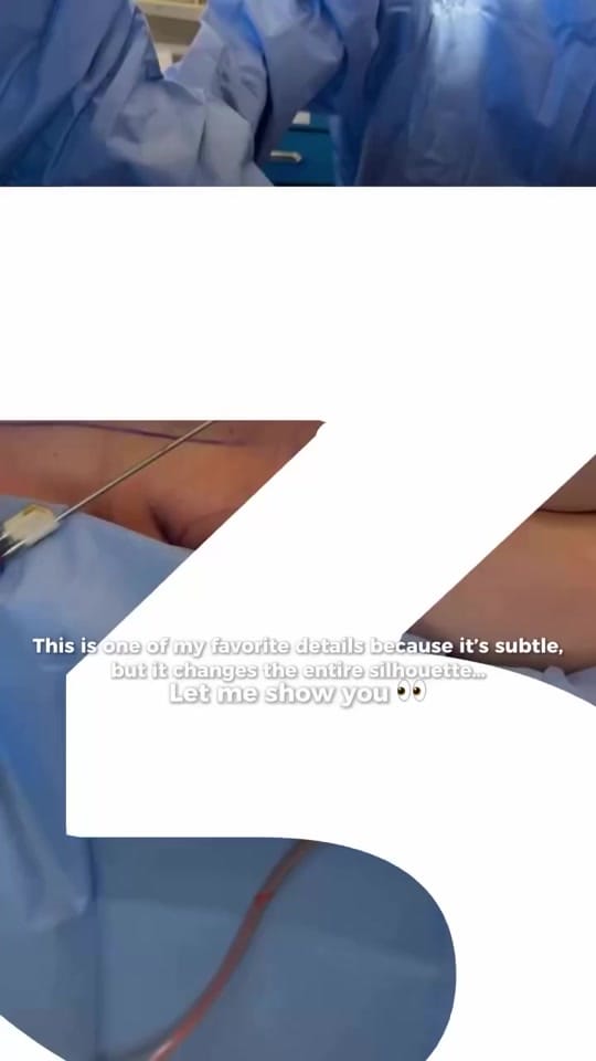 Post 2 by contouredbydrcourtney on TikTok (video)