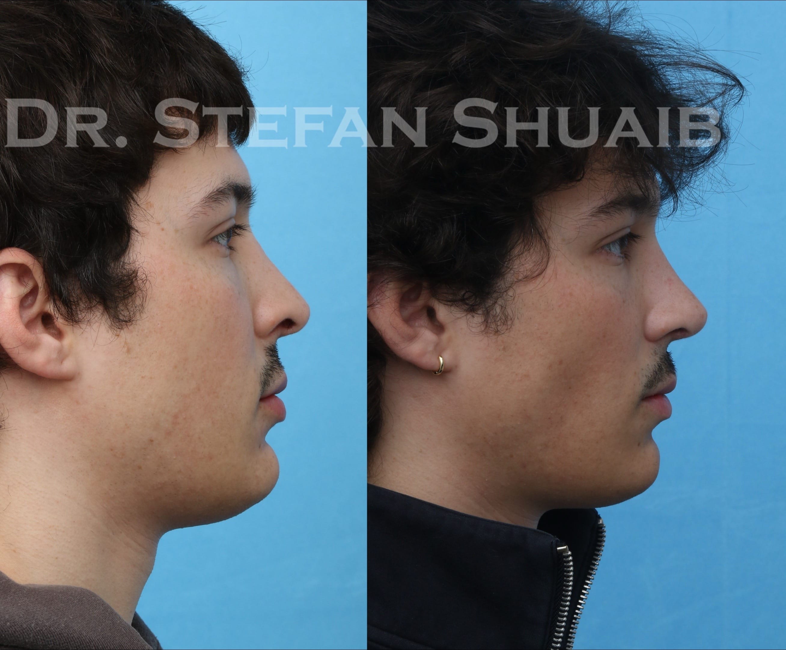 Post 1 by Stefan Shuaib MD on TikTok (video)