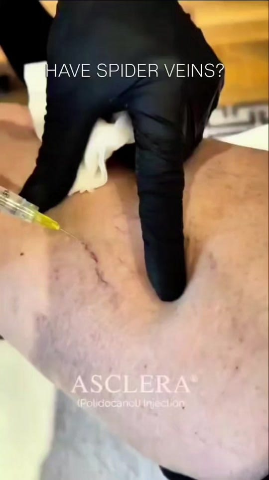 Post 9 by Eterna Cosmetic Surgery on TikTok (video)